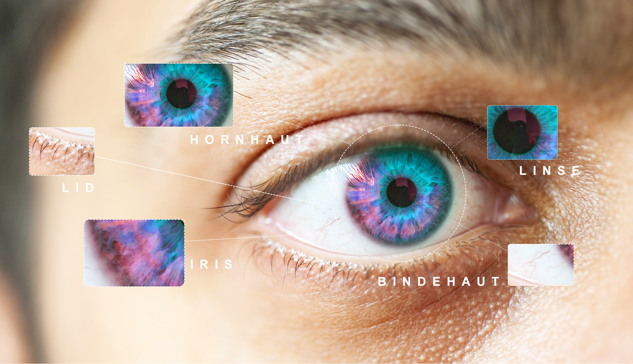 Eye conditions and treatment options